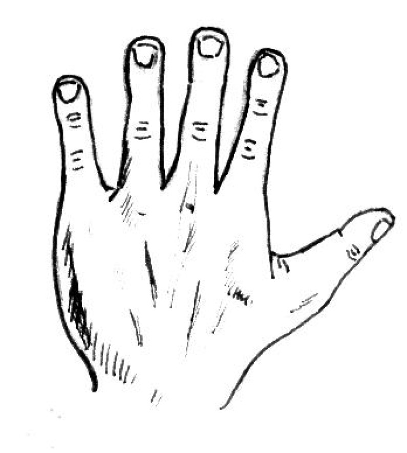 Fire Hand Fire Hand