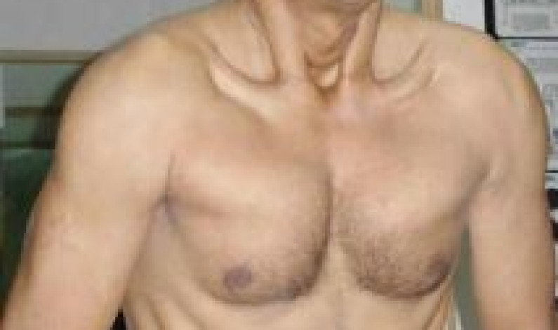 Pranayama Breathing Exercises Pranayama Breathing Exercises