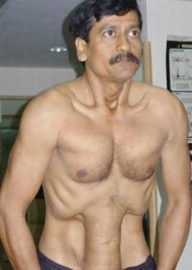 Pranayama Breathing Exercises Pranayama Breathing Exercises
