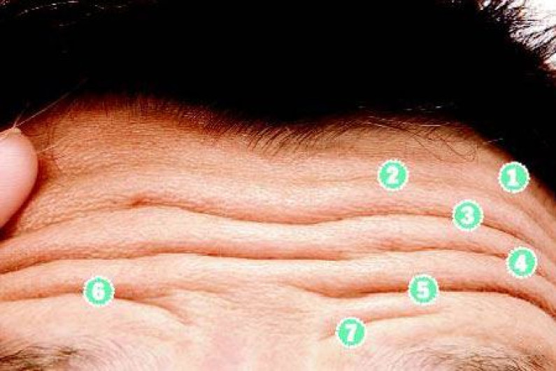 Lines On Forehead – The Line Of Wisdom Lines On Forehead – The Line Of Wisdom