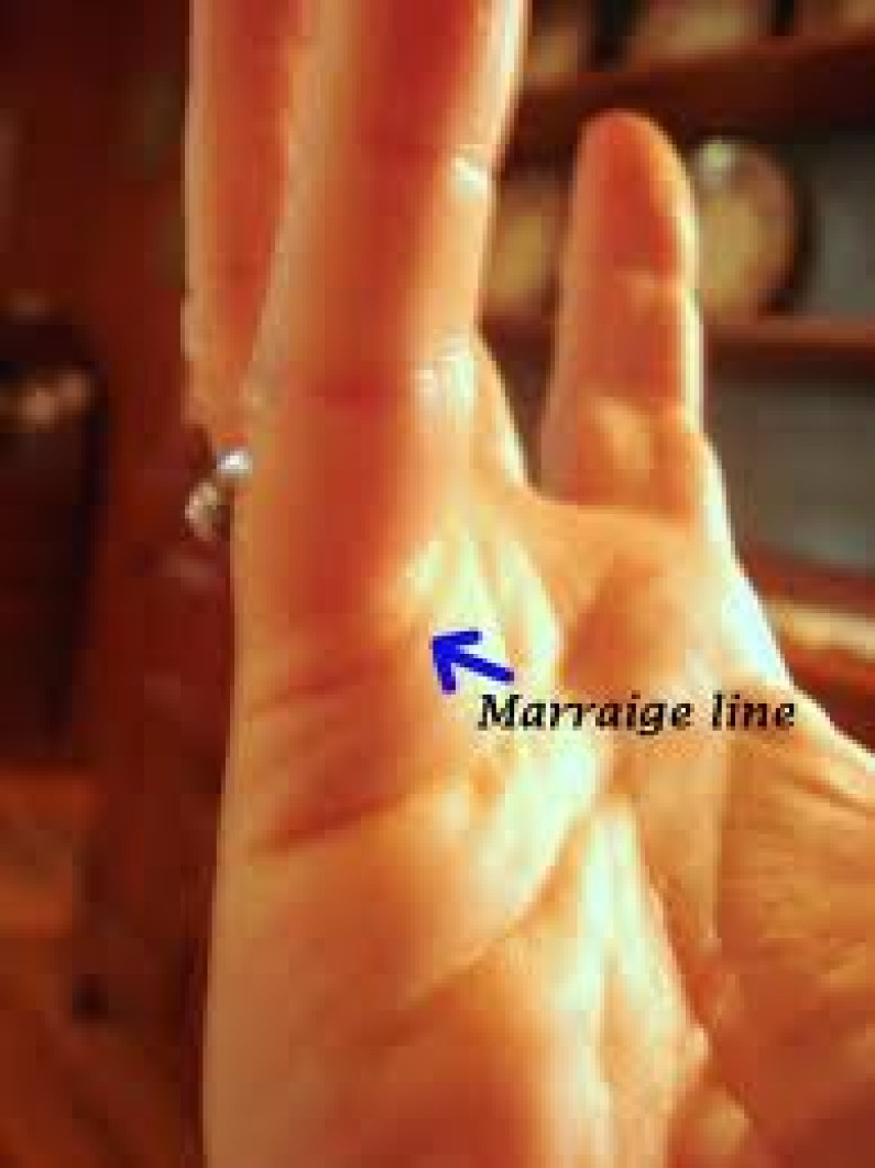 Marriage Line On Palm